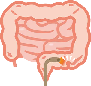 ひとつでも当てはまる方は大腸カメラ検査による精密検査を受けましょう