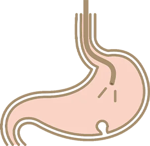 ひとつでも当てはまる方は胃カメラ検査による精密検査を受けましょう